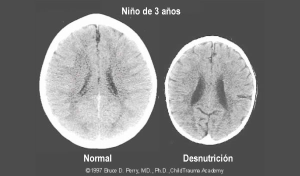 Fe en Acción